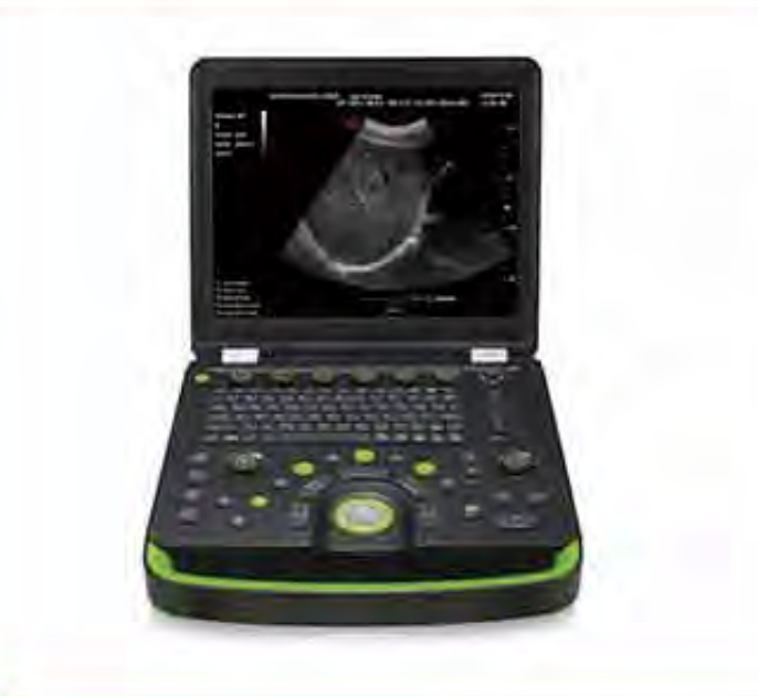 Color Doppler Ultrasound System