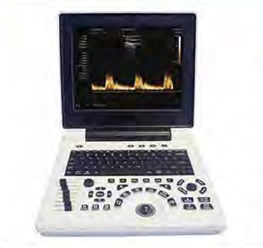 Full Digital Ultrasound Diagnostic System