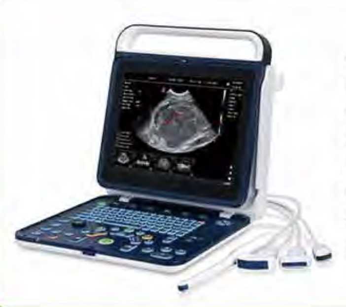 Diagnostic Color Doppler Ultrasound System
