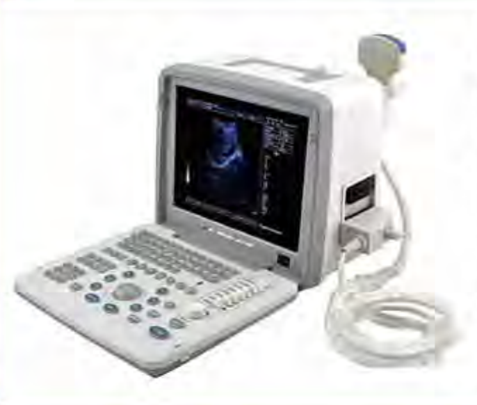 Portable Ultrasound Scanner