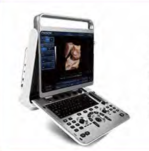 Digital Color Doppler Ultrasound System