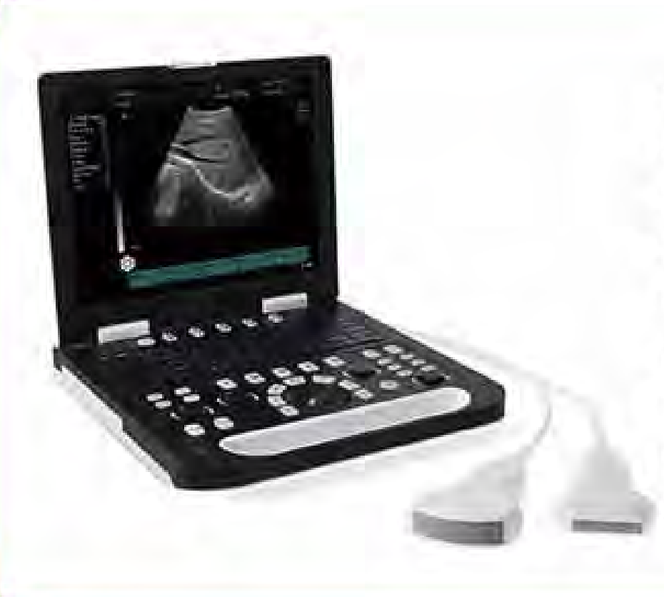 Full-digital Laptop Ultrasound Scanner