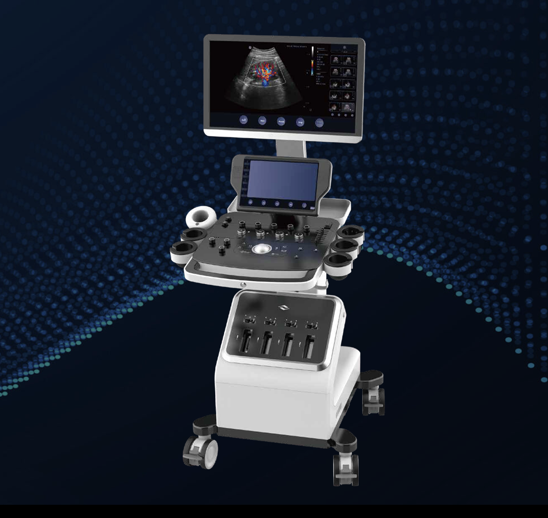 Ultrasound Diagnostic Systems