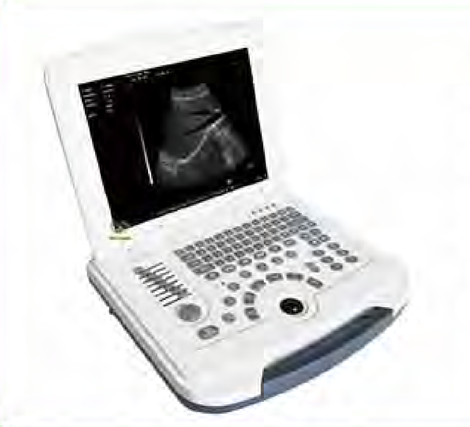 Laptop BW Ultrasound Scanner