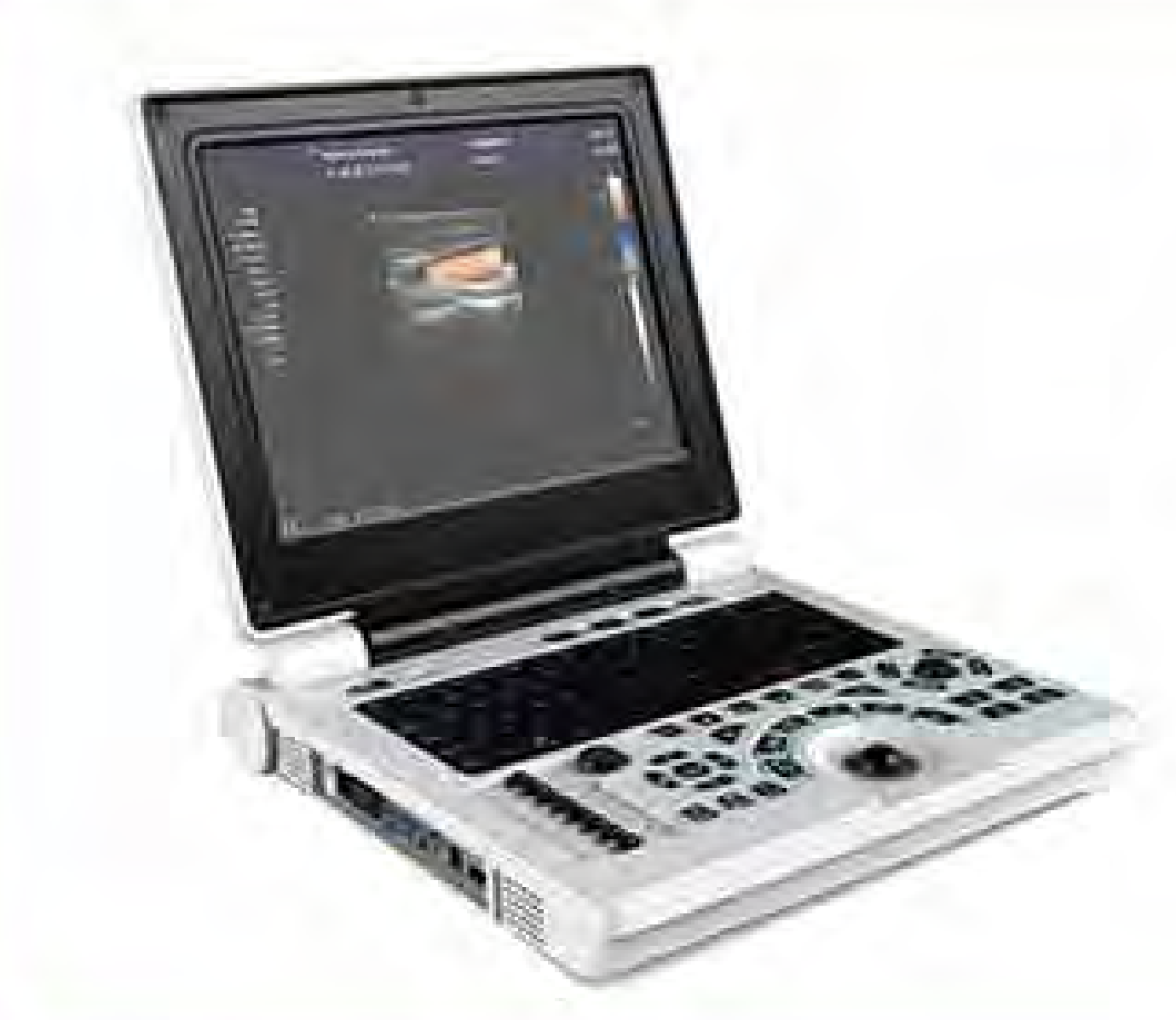 Laptop Color doppler ultrasound scanner